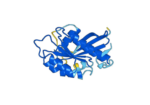 Recombinant Human RAB2A Protein, N-His