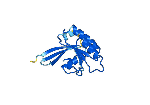 Recombinant Human RAB31 Protein, N-His