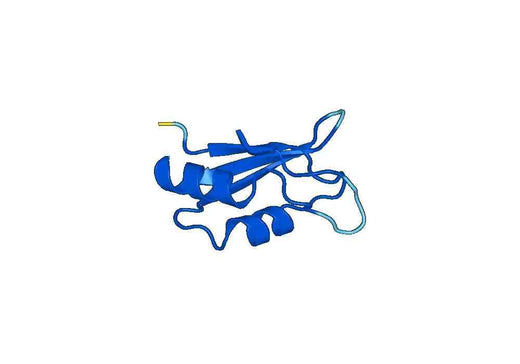 Recombinant Human RBPMS Protein, N-His-SUMO & C-Strep