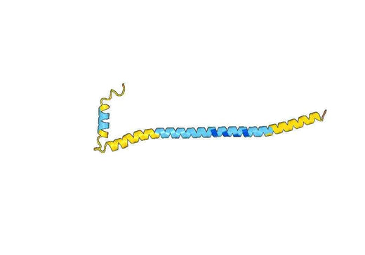 Recombinant Human REEP1 Protein, N-His-SUMO & C-Strep