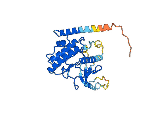Recombinant Human RIOK3 Protein, N-His