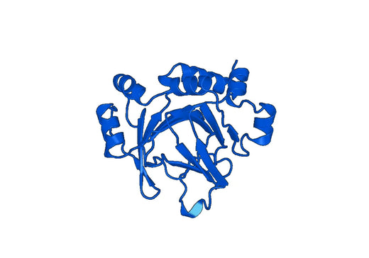 Recombinant Human RIOX2 Protein, N-His