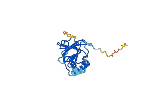 Recombinant Human SPHK1, N-His