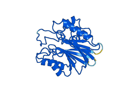 Recombinant Human TDP2 Protein, N-His