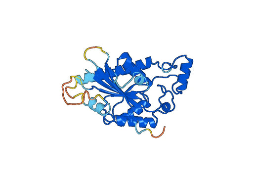 Recombinant Human TIGAR Protein, N-His