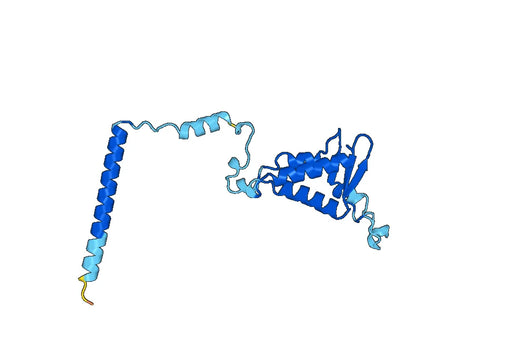Recombinant Human TIMM29 Protein, N-His