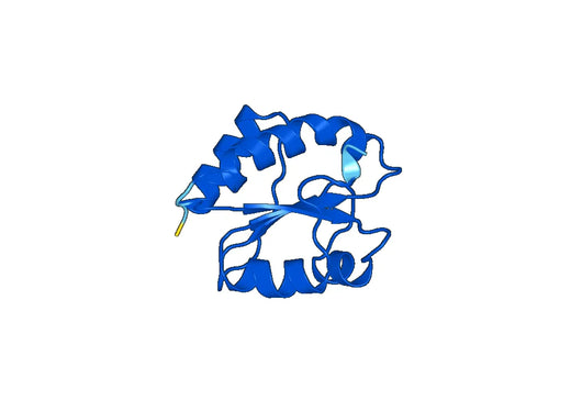 Recombinant Human TXNDC5 Protein, N-His