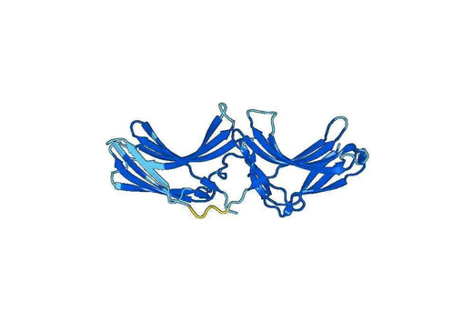 Recombinant Human VPS26B Protein, N-His