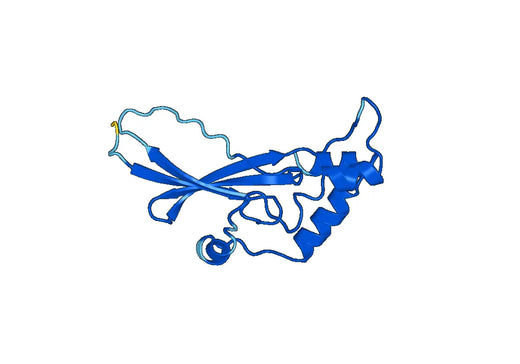 Recombinant Human XYLT1, N-His