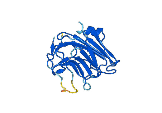 Recombinant Mouse PTX3 Protein, N-His