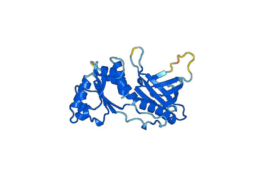 Recombinant Mouse SPHK2 Protein, N-His