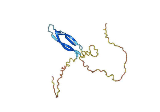 Sclerostin (SOST )