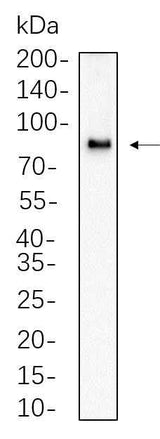 Anti-Human/Mouse/Rat/Duck CPT1A Antibody [B601]