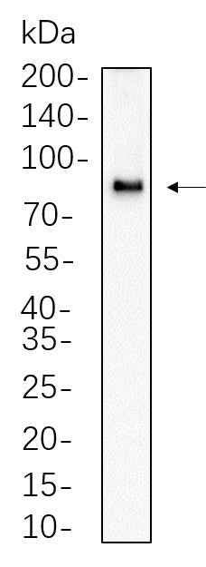 Anti-Human/Mouse/Rat/Duck CPT1A Antibody [B601] - ABMIUM