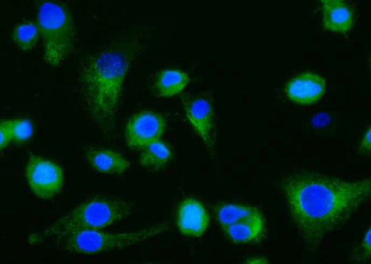 Anti-Mouse CLEC7A Antibody [B425] - ABMIUM