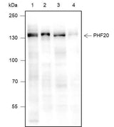 Anti-Human/Mouse PHF20 Antibody [A331]