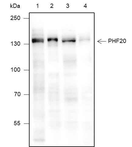 Anti-Human/Mouse PHF20 Antibody [A331]