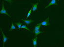 Anti-Human HPX Antibody [A1041] - ABMIUM