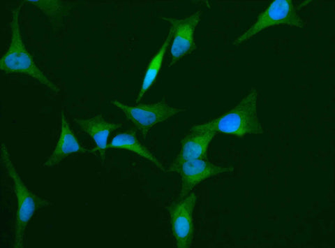 Anti-Human HPX Antibody [A1041] - ABMIUM