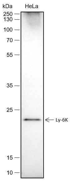 Anti-Human Ly-6K Antibody [A424]