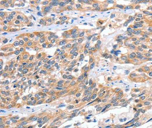 Anti-Human CGB Antibody