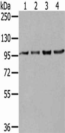 Anti-Human/Mouse/Rat NUP98 Antibody