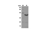 SDS-PAGE analysis of Rat Ifna2 proteins,2 μg/lane of Recombinant Rat Ifna2 proteins,was resolved with SDS-PAGE under reducing conditions,showing bands at 35 kDa.