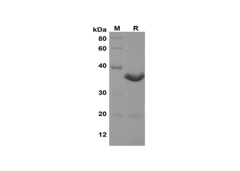 SDS-PAGE analysis of Rat Ifna2 proteins,2 μg/lane of Recombinant Rat Ifna2 proteins,was resolved with SDS-PAGE under reducing conditions,showing bands at 35 kDa.