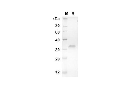 SDS-PAGE analysis of Human CD40 proteins, 2 μg/lane of Recombinant Human CD40 proteins was resolved with SDS-PAGE under reducing conditions, showing bands at 18.9 kDa.