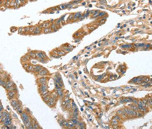 Anti-Human CKAP2 Antibody
