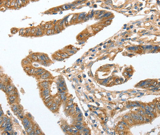 Anti-Human CKAP2 Antibody - ABMIUM