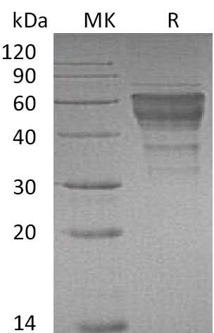 Recombinant Mouse TIM-3/HAVCR2 Protein (Fc Tag) - ABMIUM