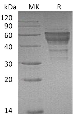 Recombinant Mouse TIM-3/HAVCR2 Protein (Fc Tag) - ABMIUM
