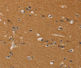 Anti-Human CHRNA4 Antibody - ABMIUM