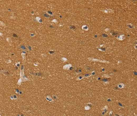 Anti-Human CHRNA4 Antibody
