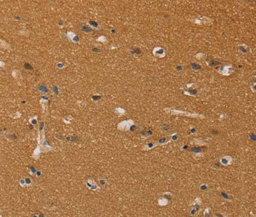 Anti-Human CHRNA4 Antibody