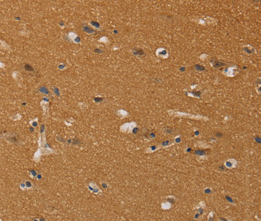 Anti-Human CHRNA4 Antibody - ABMIUM