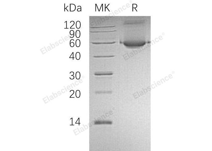 Recombinant Human ALDH1A1/ALDC Protein (His Tag) - ABMIUM