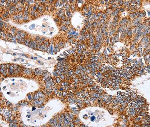 Anti-Human/Mouse/Rat MAP2K5 Antibody