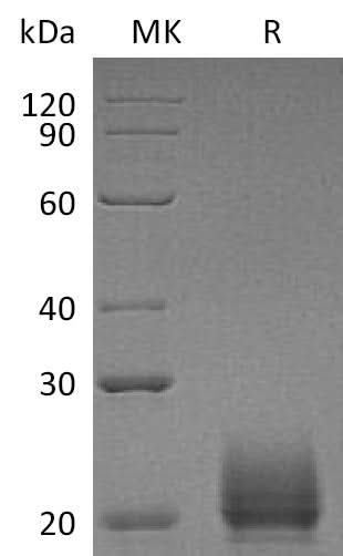 Recombinant Mouse CXCL9 Protein (His Tag) - ABMIUM