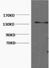 Western Blot analysis of Hela cells using COL3A1 Monoclonal Antibody at dilution of 1:1000.