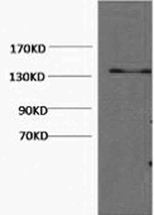Anti-Human/Mouse/Rat Collagen III Antibody [5G2]