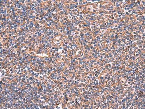 Anti-Human/Mouse TTC38 Antibody