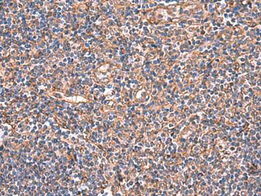 Anti-Human/Mouse TTC38 Antibody
