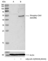 Anti-Human CHEK1 Antibody [B314]