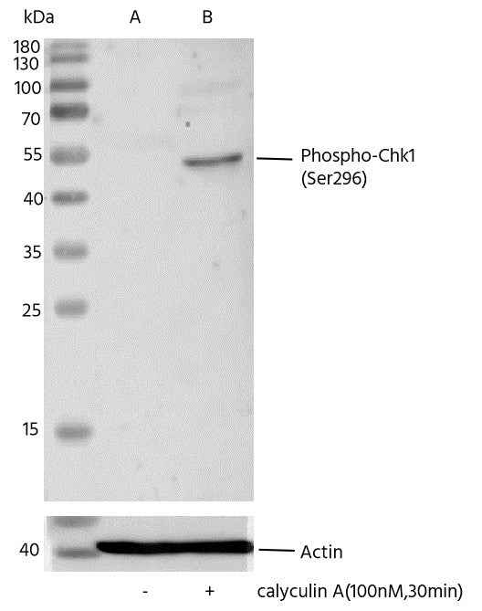Anti-Human CHEK1 Antibody [B314] - ABMIUM