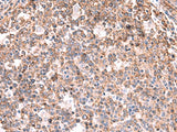 Immunohistochemistry of paraffin-embedded Human tonsil tissue using KBTBD11 Polyclonal Antibody at dilution of 1:35(×200)