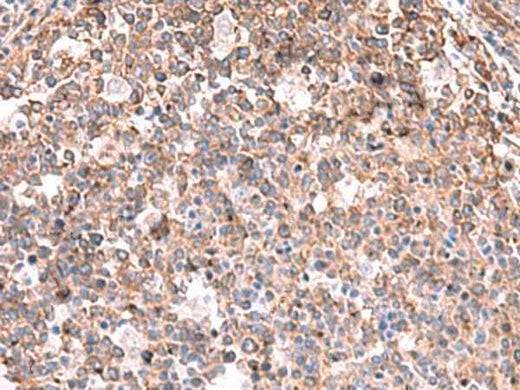 Anti-Human/Mouse KBTBD11 Antibody