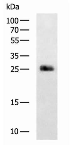 Western blot analysis of Mouse brain tissue lysates using MOG Polyclonal Antibody at dilution of 1:800