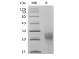 Recombinant Cynomolgus PVRIG (C-6His) - ABMIUM